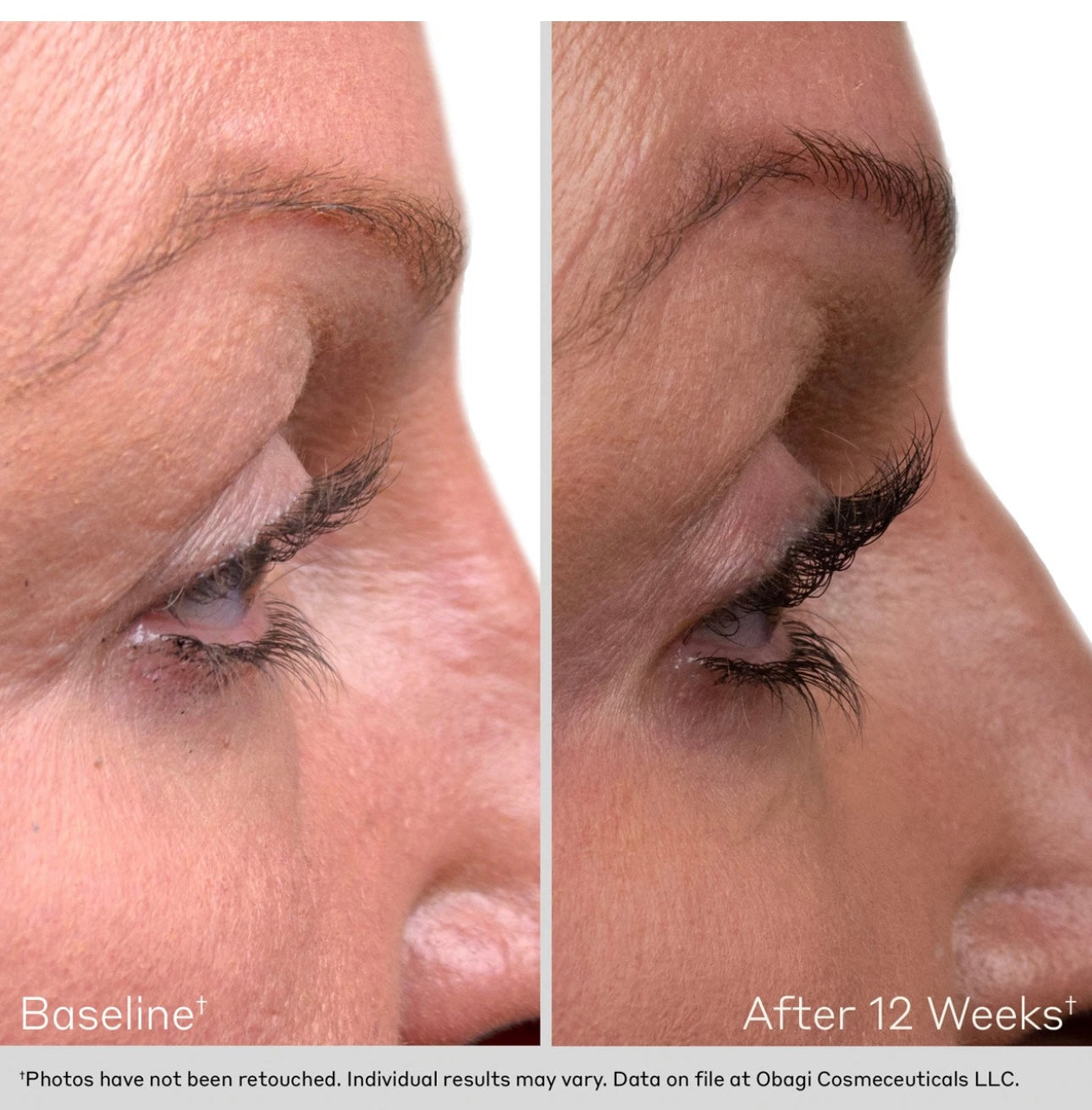 Obagi Eyelash Serum